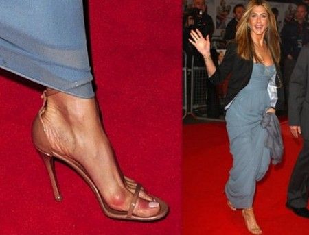 celebrity with bunion