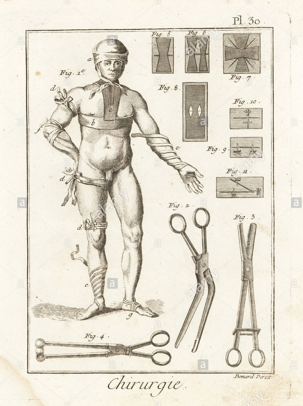 18 th century bandage sketch