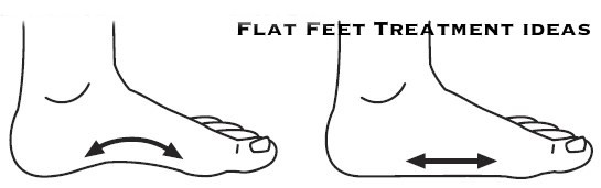 flat feet sketch