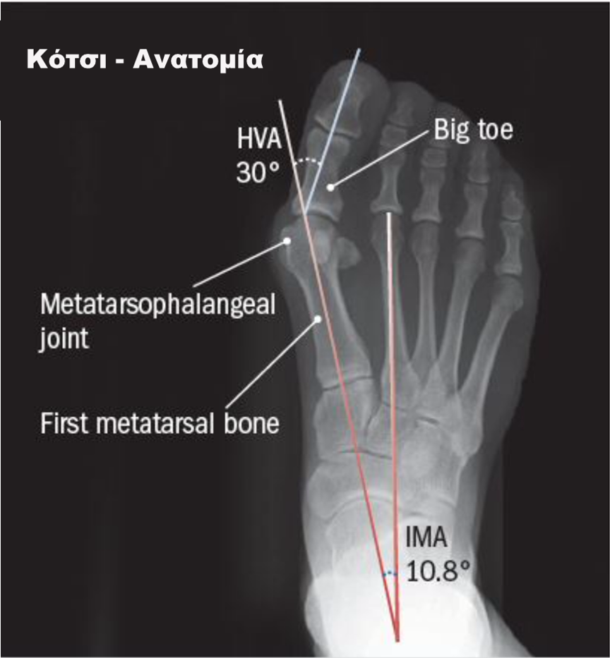 kotsi aitia kai tropoi antimetopisis harvard